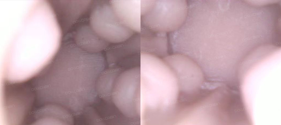inside the vaginal